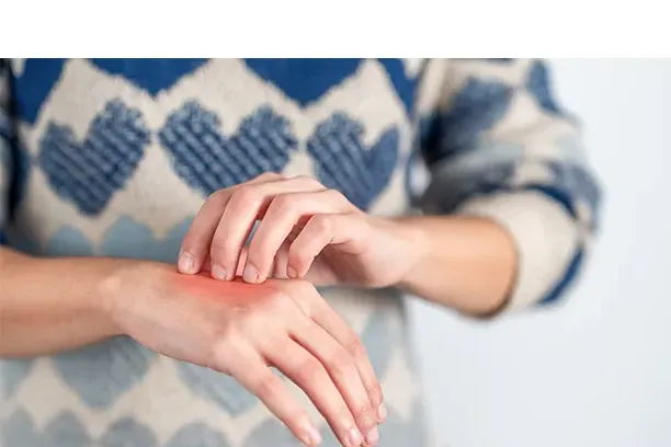 Ways to Prevent Hand Dermatitis