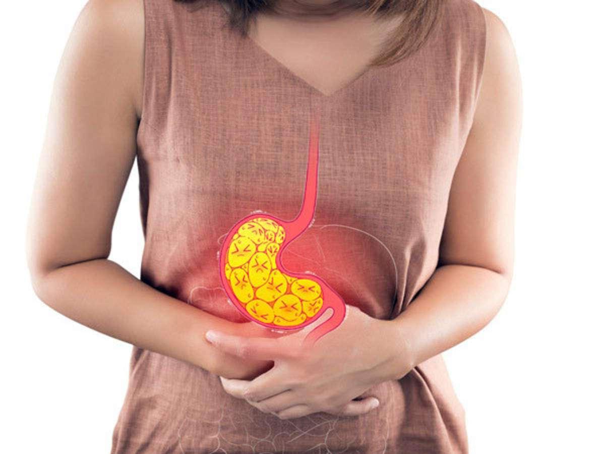 Acid Reflux: Causes，应用和发挥管理