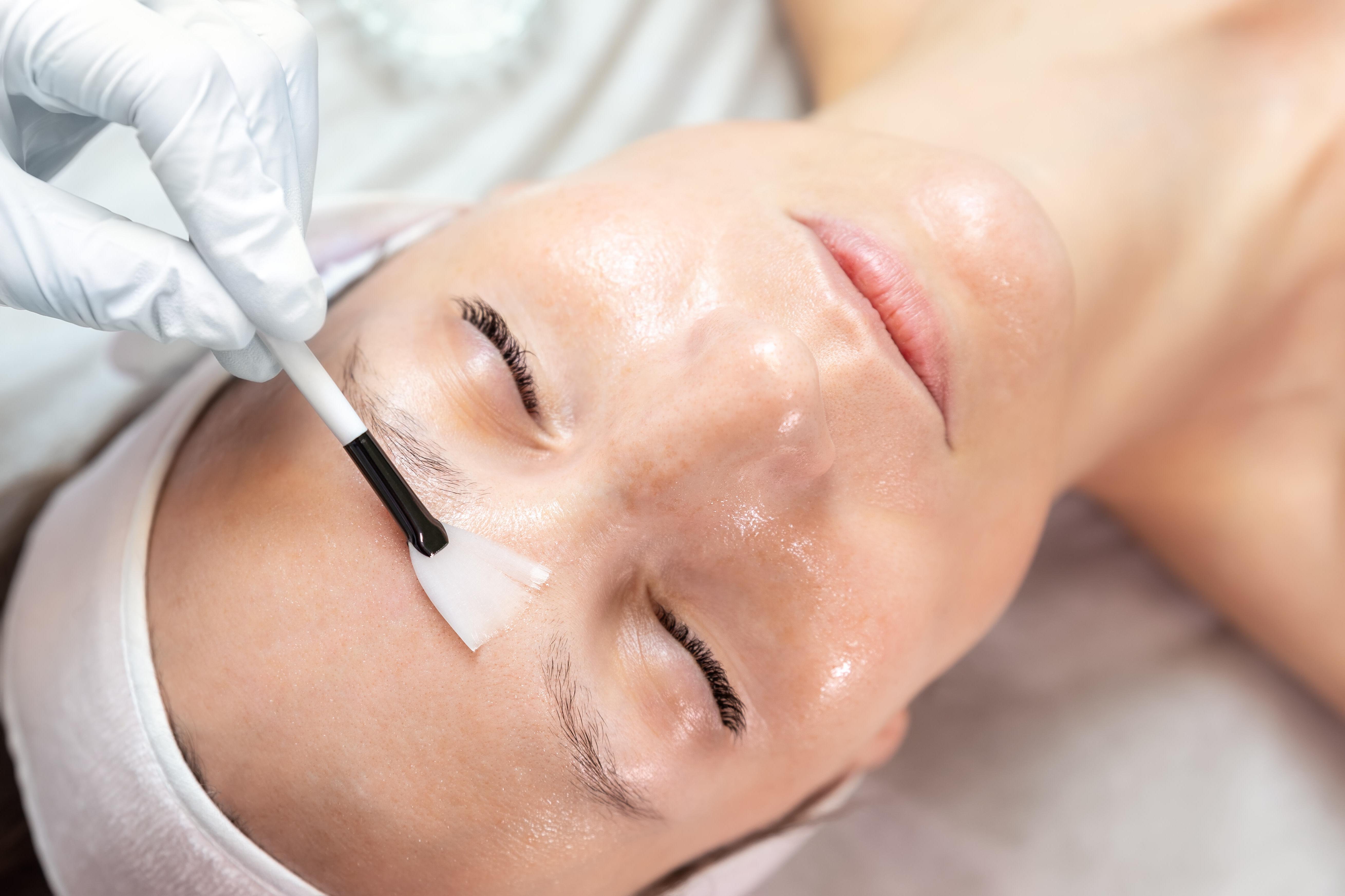 What is skin peeling treatment ?